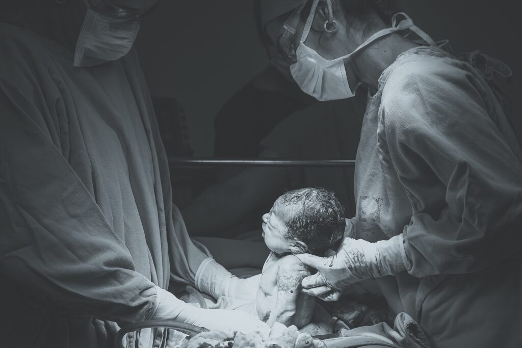 c-section birth